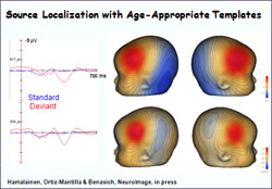 Source Localization with Age-Appropriate Templates