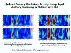 Reduced Sensory Oscillatory Activity during Rapid Auditory Processing in Children with LLI